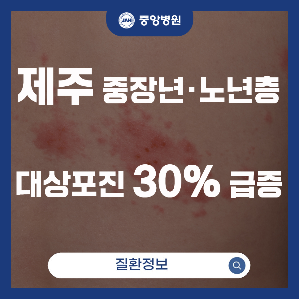 제주, 중장년·노년층 대상포진 발병률 30% 급증